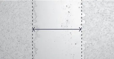 Distance 24 hours control