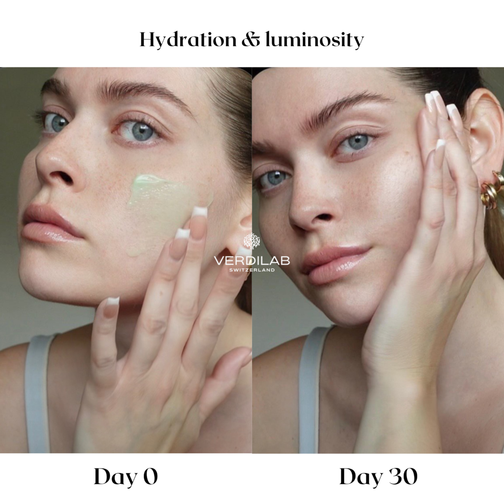 BEFOREAFTER DP 2.0 Natural Moisturiser Probiotic Cream (1)