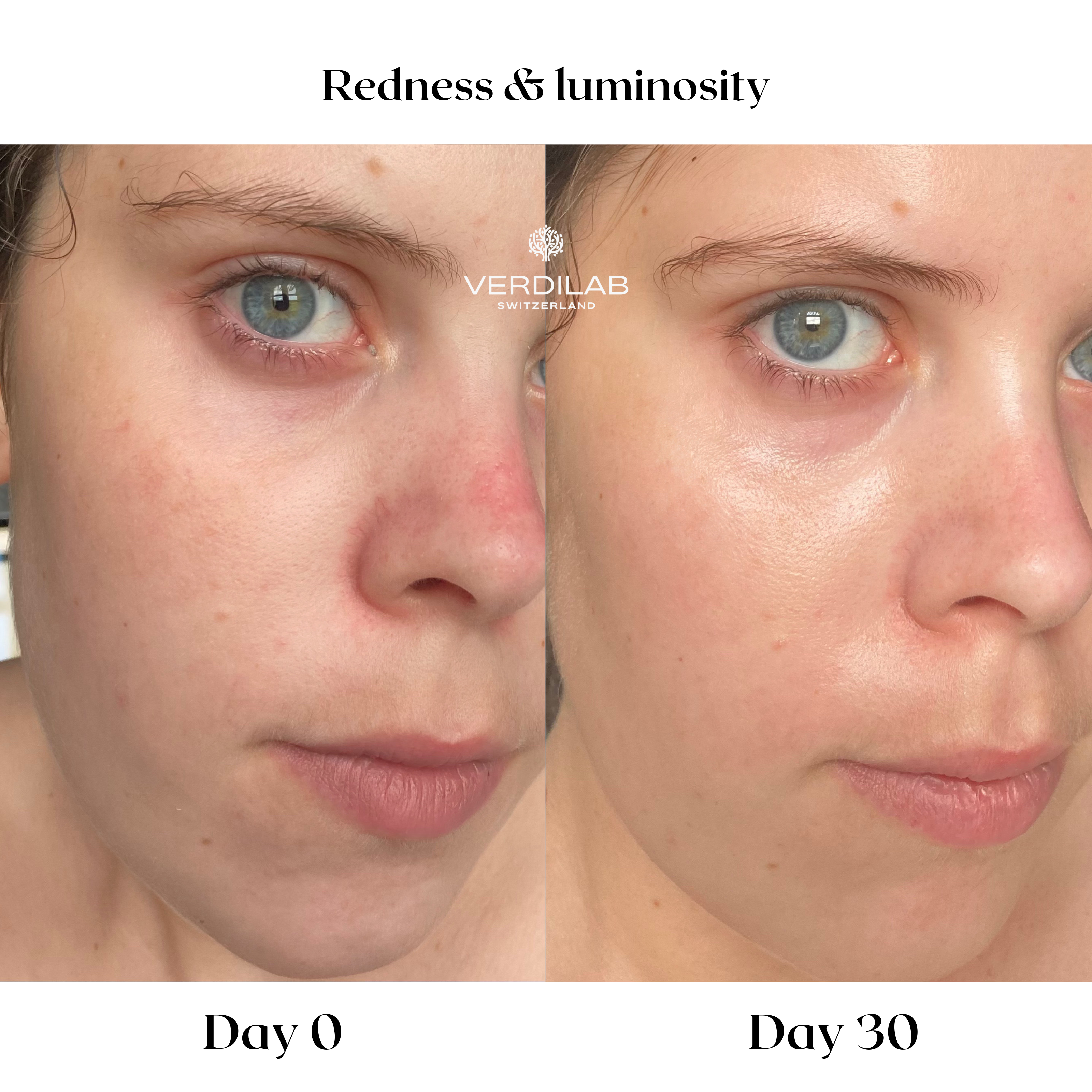 BEFOREAFTER DP 2.0 Natural Moisturiser Probiotic Cream (2)