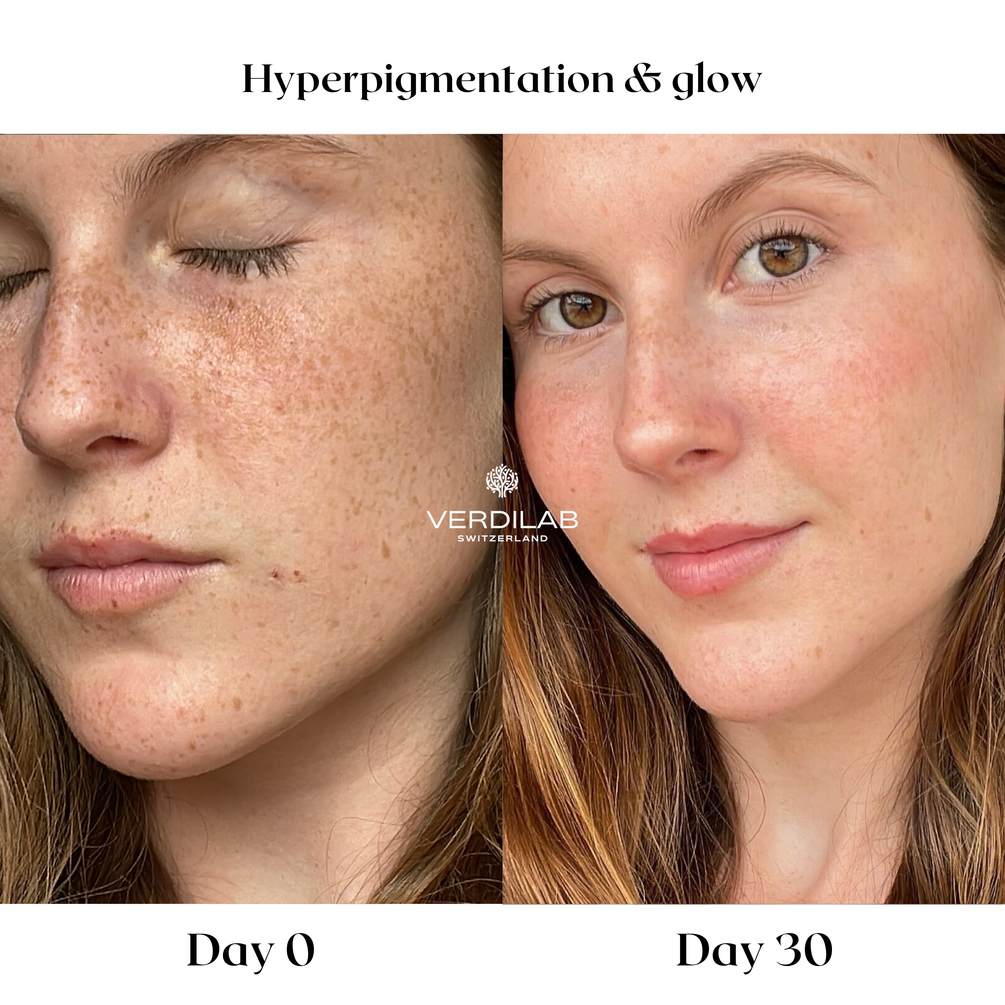 BEFOREAFTER DP 3.0 Radiance Power Vitamin C Cellular Serum