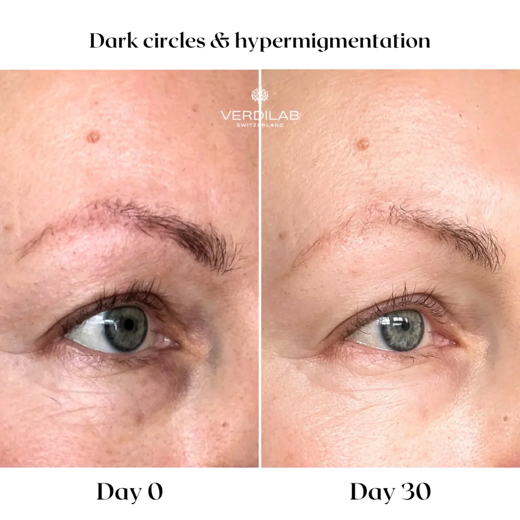 BEFOREAFTER DP 3.0 ULTIMATE LIGHTENING Vitamin C Eye Elixir 2