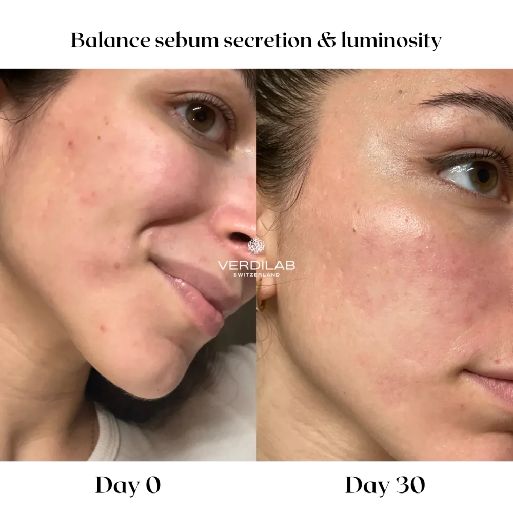 BEFOREAFTER DP 4.0 Skin Perfecting Mask