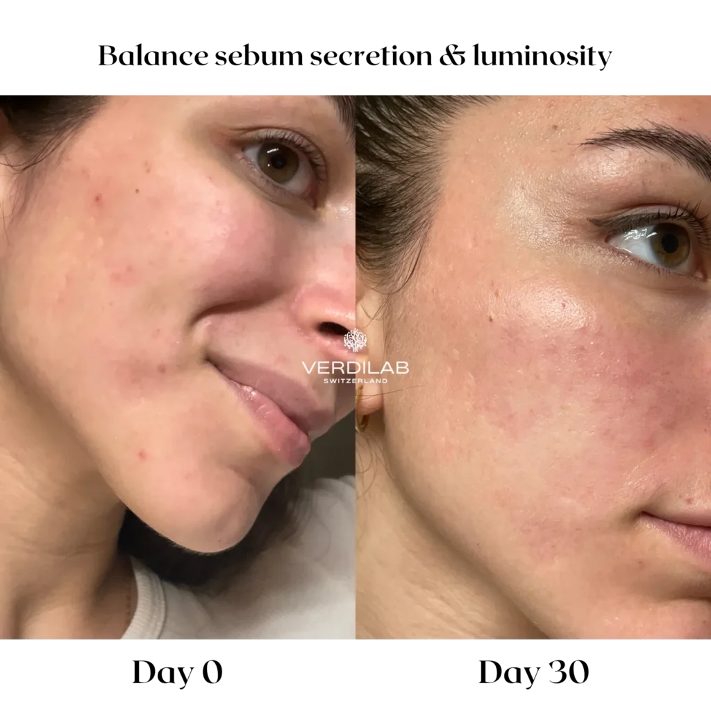 BEFOREAFTER DP 4.0 Skin Perfecting Mask