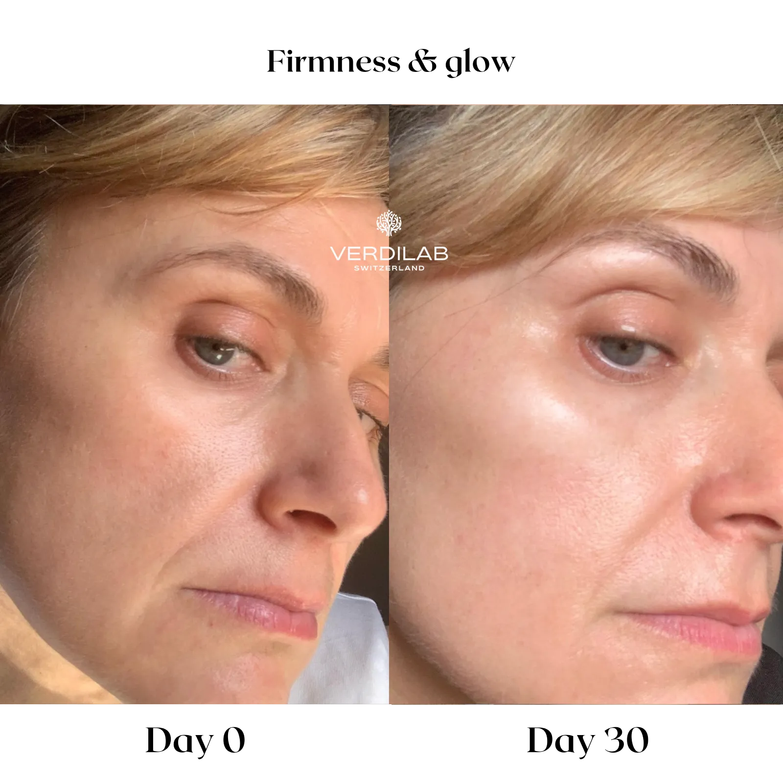 BEFOREAFTER DP 5.0 ANTI-WRINKLE Rose Supreme Cream (1)