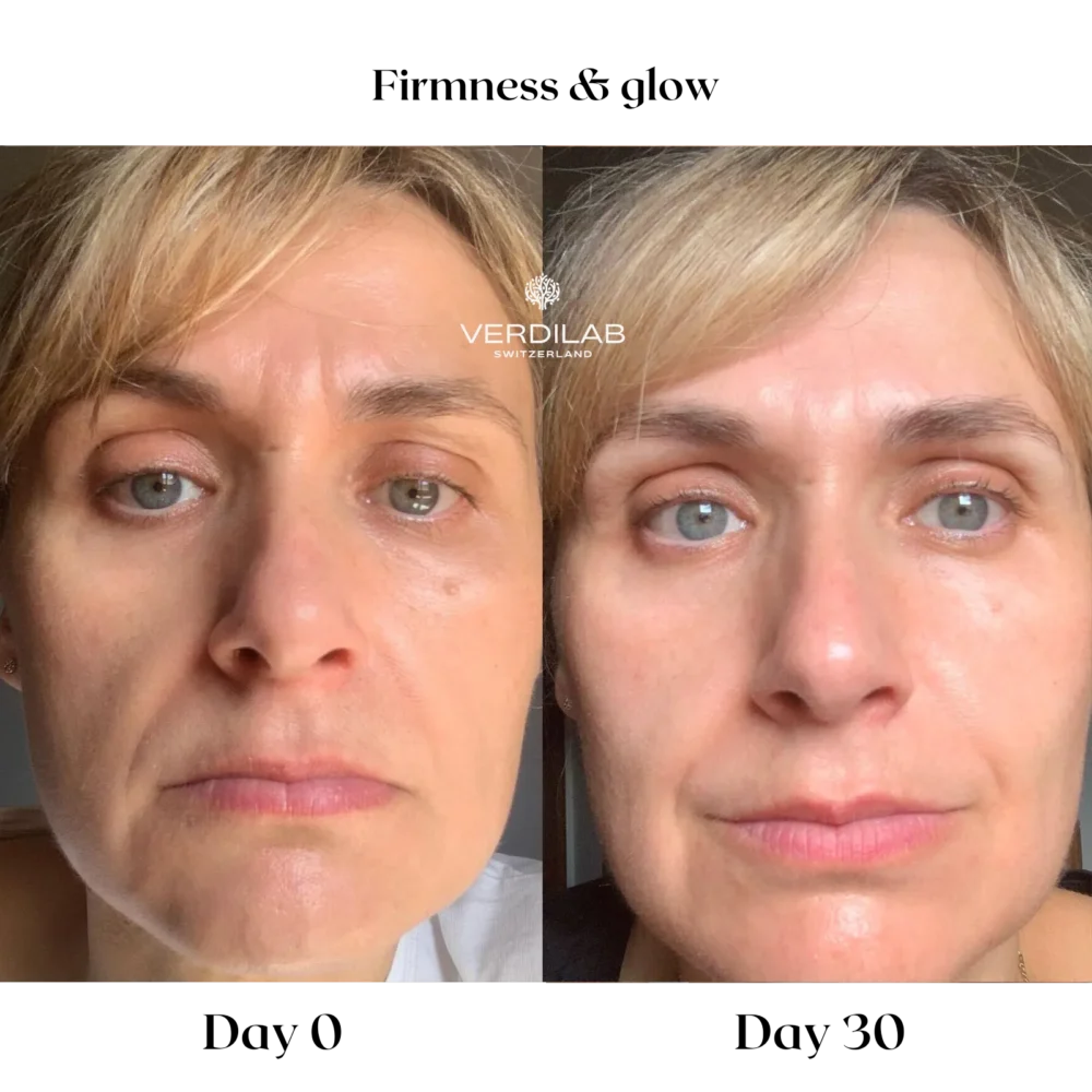 BEFOREAFTER DP 5.0 ANTI-WRINKLE Rose Supreme Cream (2)