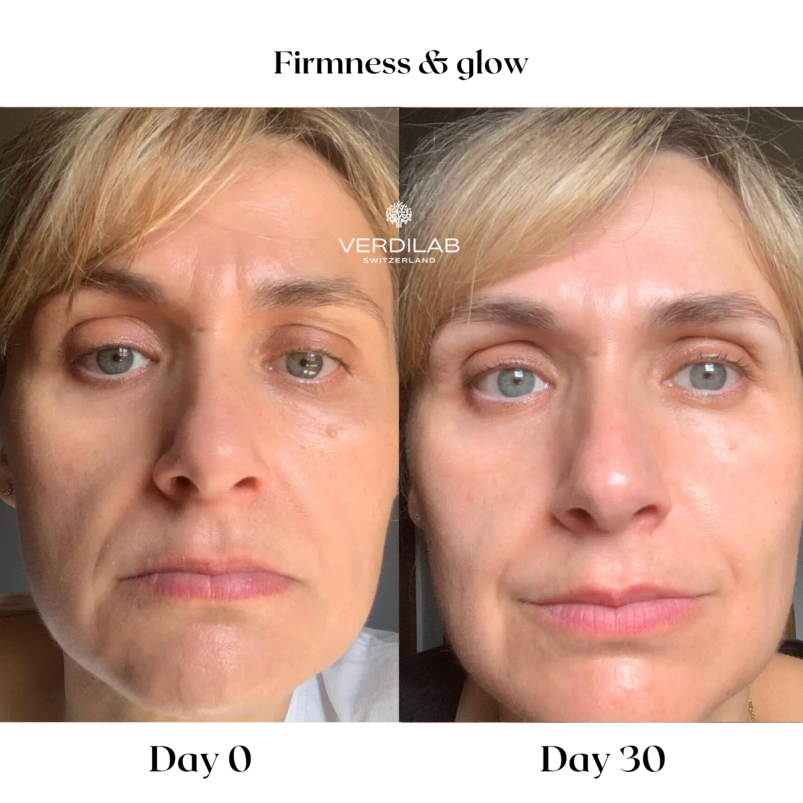 BEFOREAFTER DP 5.0 ANTI-WRINKLE Rose Supreme Cream (2)